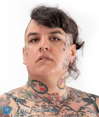 Tender Furiosa